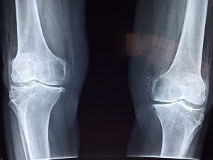 What does orthopedic and trauma medicine deal with